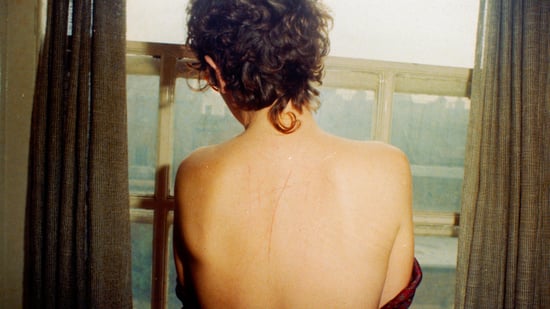 La belleza y el dolor