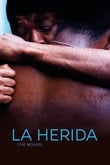 La herida (The wound)